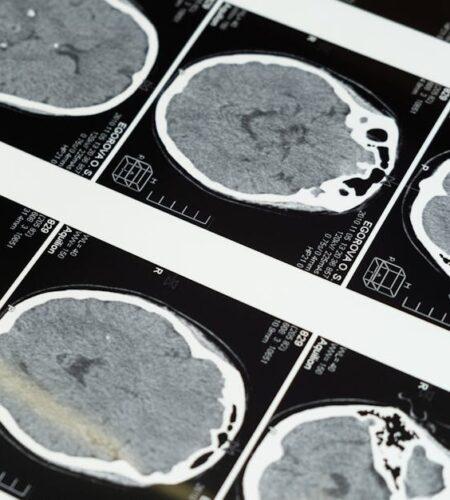 Cerveau droit ou cerveau gauche : éclaircissements sur ce mythe